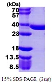 Human PPCS protein, His tag. GTX68742-pro