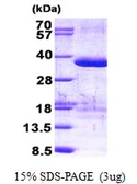 Human ZFAND1 protein, His tag. GTX68743-pro