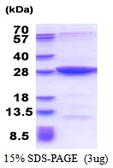 Human MOBKL2B protein, His tag. GTX68745-pro