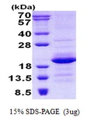 Human Gemin 6 protein, His tag. GTX68746-pro