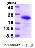 Human BAALC protein, His tag. GTX68747-pro