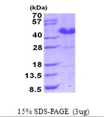 Human ASRGL1 protein, His tag. GTX68755-pro