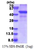 Human RNF34 protein, His tag. GTX68756-pro