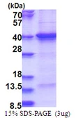 Human THAP7 protein, His tag. GTX68759-pro
