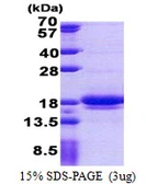 Human LIMD2 protein, His tag. GTX68762-pro
