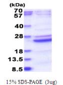 Human B9D2 protein, His tag. GTX68763-pro