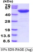 Human SETD7 protein. GTX68765-pro