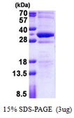 Human STMN4 protein, His tag. GTX68767-pro
