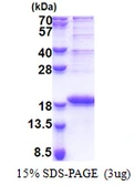 Human LBH protein, His tag. GTX68771-pro