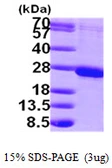 Human RAB1B protein, His tag. GTX68774-pro