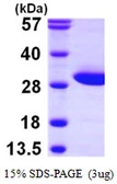 Human FAHD1 protein, His tag. GTX68775-pro