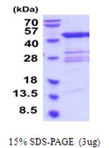 Human QTRT1 protein, His tag. GTX68776-pro