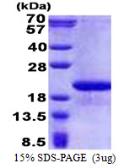 Human FAM107B protein, His tag. GTX68783-pro