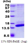 Human SH3BGRL2 protein, His tag. GTX68786-pro