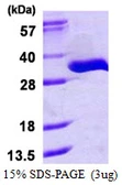 Human TRPT1 protein, His tag. GTX68787-pro