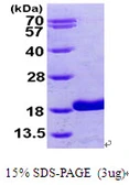 Human RBP5 protein, His tag. GTX68789-pro
