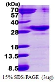 Human RAB34 protein, His tag. GTX68791-pro