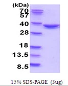 Human TATDN1 protein, His tag. GTX68792-pro