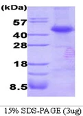 Human Dysbindin protein, His tag. GTX68795-pro
