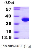 Human HDHD2 protein, His tag. GTX68796-pro