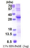 Human SLAP2 protein, His tag. GTX68798-pro