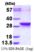 Human LDOCL protein, His tag. GTX68800-pro