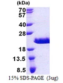 Human RPA Interacting Protein protein, His tag. GTX68802-pro