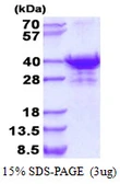 Human UTP23 protein, His tag. GTX68803-pro