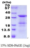 Human SLD5 protein, His tag. GTX69573-pro