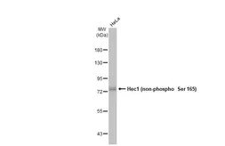 Anti-Hec1 (non-phospho Ser 165) antibody used in Western Blot (WB). GTX70012