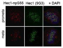 Anti-Hec1 antibody used in Immunocytochemistry/ Immunofluorescence (ICC/IF). GTX70016