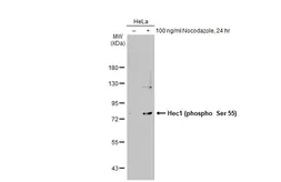 Anti-Hec1 (phospho Ser 55) antibody used in Western Blot (WB). GTX70017