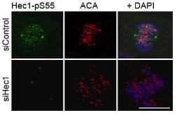 Anti-Hec1 (phospho Ser 55) antibody used in Immunocytochemistry/ Immunofluorescence (ICC/IF). GTX70017
