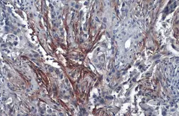 Anti-Carbonic Anhydrase IX antibody [GT12] used in IHC (Paraffin sections) (IHC-P). GTX70020