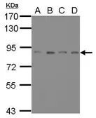 Anti-ATRIP antibody [11] used in Western Blot (WB). GTX70098