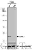 Anti-Chk2 antibody [4B8] used in Western Blot (WB). GTX70100