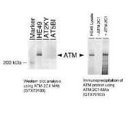 anti atm antibody 2c1 gtx70103