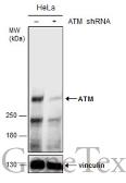 Anti-ATM antibody [2C1] used in Western Blot (WB). GTX70103
