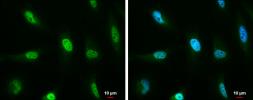 Anti-ATM antibody [5C2] used in Immunocytochemistry/ Immunofluorescence (ICC/IF). GTX70107