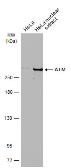 Anti-ATM antibody [5C2] used in Western Blot (WB). GTX70107