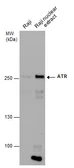 Anti-ATR antibody [2B5] used in Western Blot (WB). GTX70109