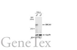 Anti-BRCA1 antibody [17F8] - ChIP grade used in Western Blot (WB). GTX70111