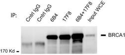 Anti-BRCA1 antibody [17F8] - ChIP grade used in Immunoprecipitation (IP). GTX70111
