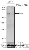 Anti-BRCA1 antibody [8F7] used in Western Blot (WB). GTX70113