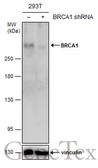 Anti-BRCA1 antibody [8F7] used in Western Blot (WB). GTX70113