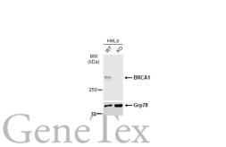 Anti-BRCA1 antibody [6B4] - ChIP grade used in Western Blot (WB). GTX70115