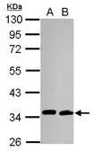 Anti-CDC34 antibody [14B5] used in Western Blot (WB). GTX70125