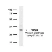 Anti-CDC34 antibody [90.12] used in Western Blot (WB). GTX70127