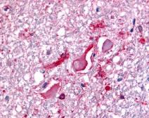 Anti-BRCA1 antibody used in Immunohistochemistry (IHC). GTX70134