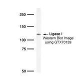 Anti-DNA ligase I antibody used in Western Blot (WB). GTX70139